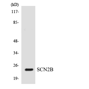 SCN2B Antibody - Western blot analysis of the lysates from HepG2 cells using SCN2B antibody.