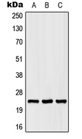 SCN2B Antibody - Western blot analysis of SCN2B expression in HEK293T (A); Raw264.7 (B); rat liver (C) whole cell lysates.