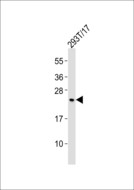 SCN2B Antibody - Anti-SCN2B Antibody at 1:1000 dilution + 293T/17 whole cell lysates Lysates/proteins at 20 ug per lane. Secondary Goat Anti-Rabbit IgG, (H+L),Peroxidase conjugated at 1/10000 dilution Predicted band size : 24 kDa Blocking/Dilution buffer: 5% NFDM/TBST.