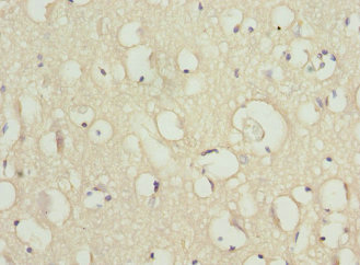 SCN2B Antibody - Immunohistochemistry of paraffin-embedded human brain tissue at dilution 1:100