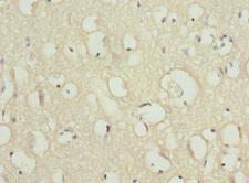 SCN2B Antibody - Immunohistochemistry of paraffin-embedded human brain tissue at dilution 1:100