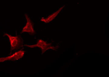 SCN2B Antibody - Staining 293 cells by IF/ICC. The samples were fixed with PFA and permeabilized in 0.1% Triton X-100, then blocked in 10% serum for 45 min at 25°C. The primary antibody was diluted at 1:200 and incubated with the sample for 1 hour at 37°C. An Alexa Fluor 594 conjugated goat anti-rabbit IgG (H+L) Ab, diluted at 1/600, was used as the secondary antibody.