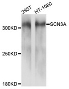 SCN3A / Nav1.3 Antibody - Western blot analysis of extracts of various cell lines, using SCN3A antibody at 1:1000 dilution. The secondary antibody used was an HRP Goat Anti-Rabbit IgG (H+L) at 1:10000 dilution. Lysates were loaded 25ug per lane and 3% nonfat dry milk in TBST was used for blocking. An ECL Kit was used for detection and the exposure time was 60s.