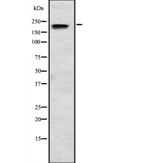 SCN3A / Nav1.3 Antibody - Western blot analysis of SCN3A expression in HEK293 cells. The lane on the left is treated with the antigen-specific peptide.