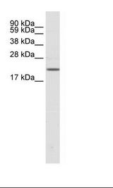 SCN3B Antibody - Fetal brain Lysate.  This image was taken for the unconjugated form of this product. Other forms have not been tested.