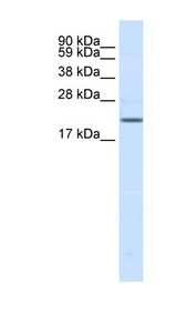 SCN3B Antibody - SCN3B antibody Western blot of Fetal brain lysate. This image was taken for the unconjugated form of this product. Other forms have not been tested.