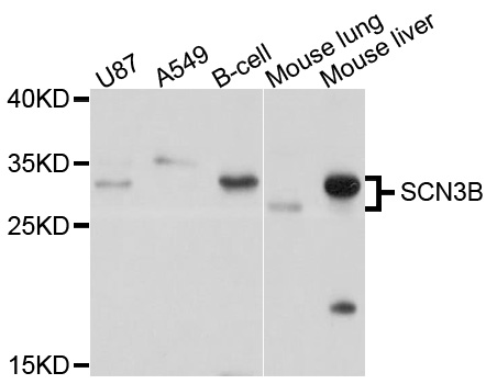 SCN3B Antibody - Western blot analysis of extracts of various cell lines, using SCN3B antibody at 1:1000 dilution. The secondary antibody used was an HRP Goat Anti-Rabbit IgG (H+L) at 1:10000 dilution. Lysates were loaded 25ug per lane and 3% nonfat dry milk in TBST was used for blocking. An ECL Kit was used for detection and the exposure time was 5s.