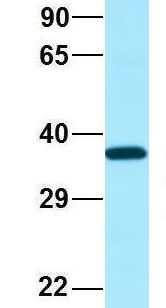 SCN4 / G6PC3 Antibody - SCN4 / G6PC3 antibody Western Blot of Human Fetal Heart. Antibody Dilution: 1.0ug/ml. Antibody dilution: 1 ug/ml.  This image was taken for the unconjugated form of this product. Other forms have not been tested.