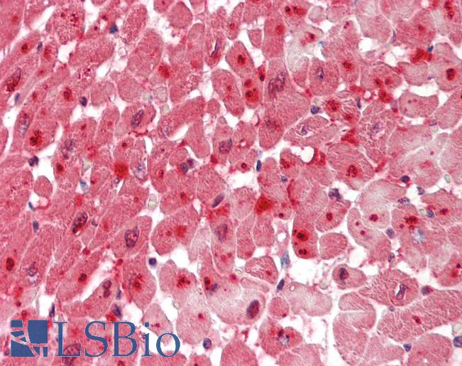 SCN4 / G6PC3 Antibody - Human Heart: Formalin-Fixed, Paraffin-Embedded (FFPE).  This image was taken for the unconjugated form of this product. Other forms have not been tested.