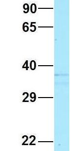 SCN4 / G6PC3 Antibody - SCN4 / G6PC3 antibody Western Blot of HeLa lysate. Antibody Dilution: 1.0 ug/ml. G6PC3 is strongly supported by BioGPS gene expression data to be expressed in HeLa. Antibody dilution: 1 ug/ml.  This image was taken for the unconjugated form of this product. Other forms have not been tested.