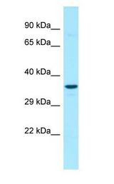SCN4 / G6PC3 Antibody - SCN4 / G6PC3 antibody Western Blot of 721_B whole cell lysate.  This image was taken for the unconjugated form of this product. Other forms have not been tested.