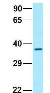 SCN4 / G6PC3 Antibody - SCN4 / G6PC3 antibody Western Blot of Human Fetal Brain. Antibody Dilution: 1.0ug/ml. Antibody dilution: 1 ug/ml.  This image was taken for the unconjugated form of this product. Other forms have not been tested.