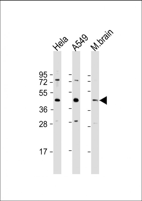 SCN4 / G6PC3 Antibody - All lanes: Anti-G6PC3 Antibody (C-Term) at 1:1000 dilution Lane 1: Hela whole cell lysate Lane 2: A549 whole cell lysate Lane 3: mouse brain lysate Lysates/proteins at 20 µg per lane. Secondary Goat Anti-Rabbit IgG, (H+L), Peroxidase conjugated at 1/10000 dilution. Predicted band size: 39 kDa Blocking/Dilution buffer: 5% NFDM/TBST.