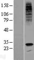 SCN4 / G6PC3 Protein - Western validation with an anti-DDK antibody * L: Control HEK293 lysate R: Over-expression lysate