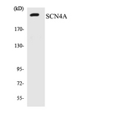SCN4A / Nav1.4 Antibody - Western blot analysis of the lysates from COLO205 cells using SCN4A antibody.