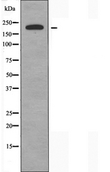 SCN4A / Nav1.4 Antibody - Western blot analysis of extracts of K562 cells using SCN4A antibody.