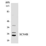 SCN4B Antibody - Western blot analysis of the lysates from HeLa cells using SCN4B antibody.
