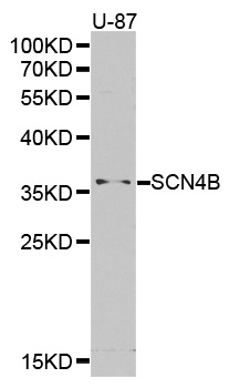 SCN4B Antibody - Western blot analysis of extracts of U-87 cell lines.