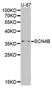 SCN4B Antibody - Western blot analysis of extracts of U-87 cell lines.