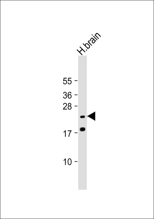 SCN4B Antibody - Anti-SCN4B Antibody at 1:1000 dilution + human brain lysate Lysates/proteins at 20 ug per lane. Secondary Goat Anti-Rabbit IgG, (H+L), Peroxidase conjugated at 1:10000 dilution. Predicted band size: 25 kDa. Blocking/Dilution buffer: 5% NFDM/TBST.