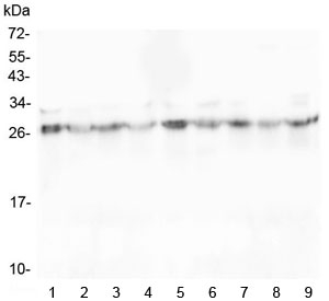 SCN4B Antibody - Western blot testing of 1) rat brain, 2) rat heart, 3) rat spleen, 4) rat kidney, 5) mouse brain, 6) mouse heart, 7) mouse spleen, 8) mouse kidney and 9) mouse Neuro-2a lysate with SCN4B antibody at 0.5ug/ml. Predicted molecular weight: 25-38 kDa depending on level of glycosylation.