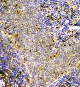 SCN4B Antibody - IHC staining of FFPE human rat spleen with SCN4B antibody at 1ug/ml. HIER: boil tissue sections in pH6, 10mM citrate buffer, for 10-20 min and allow to cool before testing.