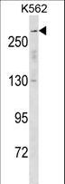 SCN5A / Nav1.5 Antibody - SCN5A Antibody western blot of K562 cell line lysates (35 ug/lane). The SCN5A antibody detected the SCN5A protein (arrow).
