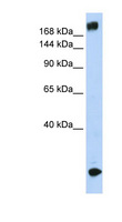 SCN5A / Nav1.5 Antibody - SCN5A / Nav1.5 antibody Western blot of Fetal Muscle lysate. This image was taken for the unconjugated form of this product. Other forms have not been tested.
