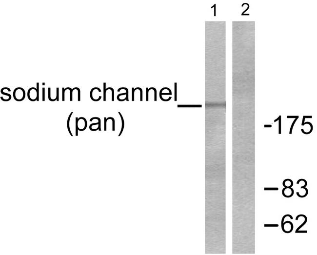 SCN5A / Nav1.5 Antibody - Western blot analysis of extracts from HuvEc cells, using Sodium Channel-pan Antibody.