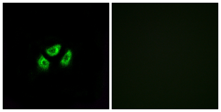 SCN7A Antibody - Immunofluorescence analysis of A549 cells, using SCN7A Antibody. The picture on the right is blocked with the synthesized peptide.
