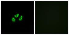 SCN7A Antibody - Immunofluorescence analysis of A549 cells, using SCN7A Antibody. The picture on the right is blocked with the synthesized peptide.