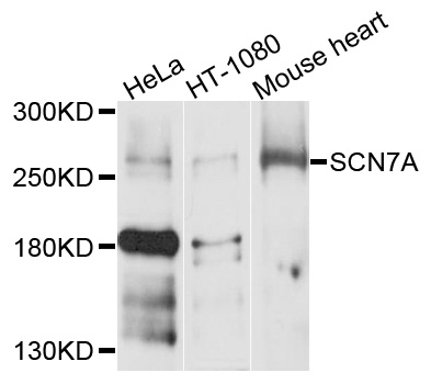 SCN7A Antibody - Western blot analysis of extracts of various cell lines, using SCN7A antibody at 1:1000 dilution. The secondary antibody used was an HRP Goat Anti-Rabbit IgG (H+L) at 1:10000 dilution. Lysates were loaded 25ug per lane and 3% nonfat dry milk in TBST was used for blocking. An ECL Kit was used for detection and the exposure time was 10s.