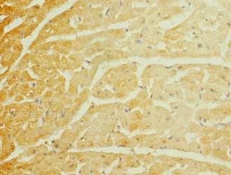 SCN7A Antibody - Immunohistochemistry of paraffin-embedded human heart tissue at dilution 1:100