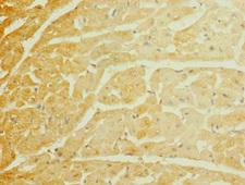 SCN7A Antibody - Immunohistochemistry of paraffin-embedded human heart tissue at dilution 1:100