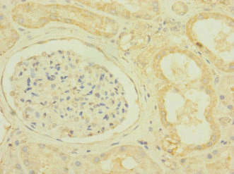 SCN7A Antibody - Immunohistochemistry of paraffin-embedded human kidney tissue at dilution 1:100