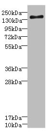 SCN7A Antibody - Western blot All Lanes: SCN7A antibody IgG at 2.36ug/ml+ Jurkat whole cell lysate Secondary Goat polyclonal to rabbit IgG at 1/10000 dilution Predicted band size: 193 kDa Observed band size: 193 kDa
