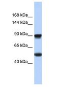 SCN8A / Nav1.6 Antibody - SCN8A / Nav1.6 antibody Western Blot of Fetal Heart. Antibody dilution: 1 ug/ml.  This image was taken for the unconjugated form of this product. Other forms have not been tested.