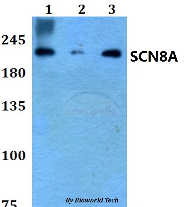 SCN8A / Nav1.6 Antibody - Western blot of SCN8A antibody at 1:500 dilution. Lane 1: HEK293T whole cell lysate. Lane 2: Raw264.7 whole cell lysate. Lane 3: PC12 whole cell lysate.