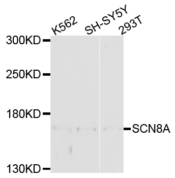 SCN8A / Nav1.6 Antibody - Western blot analysis of extracts of various cell lines, using SCN8A antibody at 1:1000 dilution. The secondary antibody used was an HRP Goat Anti-Rabbit IgG (H+L) at 1:10000 dilution. Lysates were loaded 25ug per lane and 3% nonfat dry milk in TBST was used for blocking. An ECL Kit was used for detection and the exposure time was 90s.