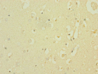 SCN8A / Nav1.6 Antibody - Immunohistochemistry of paraffin-embedded human brain tissue at dilution 1:100