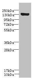 SCN8A / Nav1.6 Antibody - Western blot All Lanes: SCN8A antibody IgG at 1.18ug/ml+ Rat heart tissue Secondary Goat polyclonal to rabbit IgG at 1/10000 dilution Predicted band size: 226,227,146,221 kDa Observed band size: 225 kDa