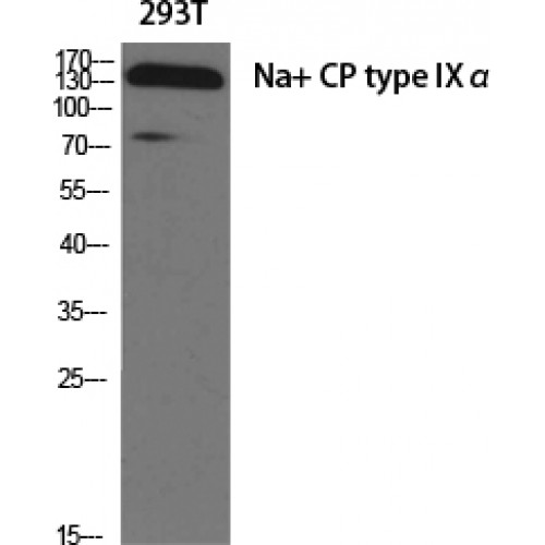 SCN9A / Nav1.7 Antibody - Western blot of Na+ CP type IX alpha antibody