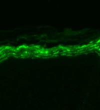 SCN9A / Nav1.7 Antibody - Nav1.7 (S68-6), Mouse back skin.  This image was taken for the unconjugated form of this product. Other forms have not been tested.