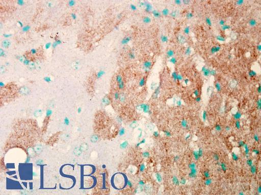 SCN9A / Nav1.7 Antibody - IHC analysis of Nav1.7 in mouse brain tissue using a dilution of SCN9A / Nav1.7 antibody.  This image was taken for the unconjugated form of this product. Other forms have not been tested.