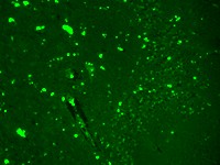 SCN9A / Nav1.7 Antibody - Nav1.7 (S68-6), Human hippocampus.  This image was taken for the unconjugated form of this product. Other forms have not been tested.