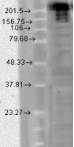 SCN9A / Nav1.7 Antibody - Detection of Nav1.7 in CHO cells with Nav1.7 Na+ Channel Monoclonal Antibody at 1ug/ml.