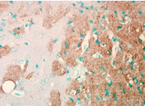 SCN9A / Nav1.7 Antibody - Detection of Nav1.7 in mouse brain with Nav1.7 Na+ Channel Monoclonal Antibody at 1ug/ml.