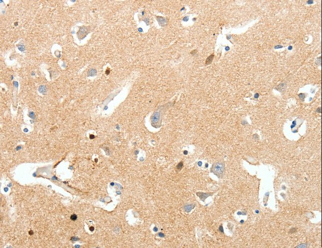 SCN9A / Nav1.7 Antibody - Immunohistochemistry of paraffin-embedded Human brain using SCN9A Polyclonal Antibody at dilution of 1:40.