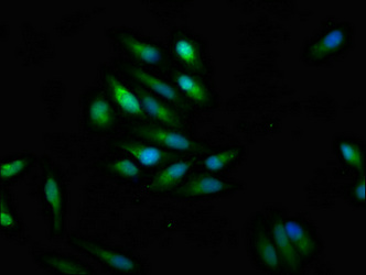 SCN9A / Nav1.7 Antibody - Immunofluorescence staining of Hela cells at a dilution of 1:100, counter-stained with DAPI. The cells were fixed in 4% formaldehyde, permeabilized using 0.2% Triton X-100 and blocked in 10% normal Goat Serum. The cells were then incubated with the antibody overnight at 4 °C.The secondary antibody was Alexa Fluor 488-congugated AffiniPure Goat Anti-Rabbit IgG (H+L) .