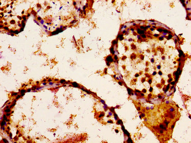 SCN9A / Nav1.7 Antibody - Immunohistochemistry image at a dilution of 1:300 and staining in paraffin-embeddedhuman testis tissue performed on a Leica BondTM system. After dewaxing and hydration, antigen retrieval was mediated by high pressure in a citrate buffer (pH 6.0) . Section was blocked with 10% normal goat serum 30min at RT. Then primary antibody (1% BSA) was incubated at 4 °C overnight. The primary is detected by a biotinylated secondary antibody and visualized using an HRP conjugated ABC system.